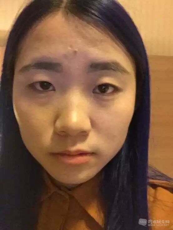 术前