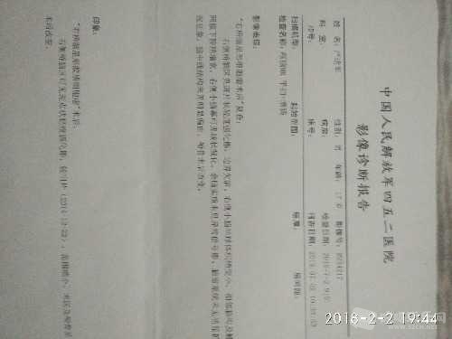 IMG_20180202_194409.jpg
